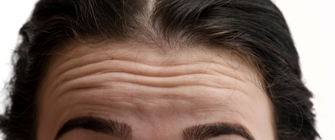 علاج تجاعيد الوجه: هل هو مُمكن؟