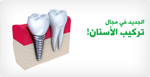 الجديد في مجال تركيب الأسنان!
