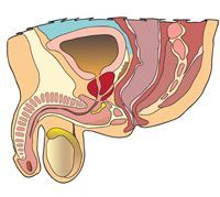 Prostatitis ami néz ki Krónikus bakteriális prosztatagyulladás okai és kezelése