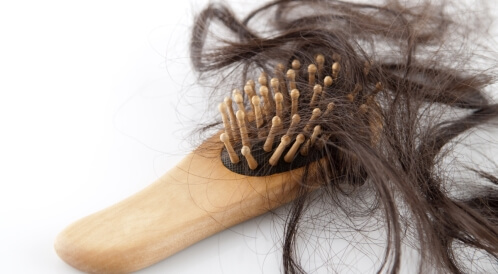 هل عاداتك تسبب تساقط شعرك؟