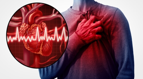 هل أنت معرض للإصابة بالجلطة القلبية؟
