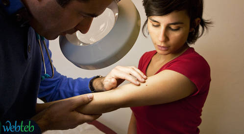 بحث جديد يشرح ويكشف اسرار انتشار سرطان من الجلد