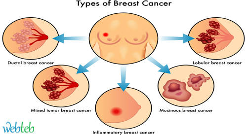 جمعية السرطان توصي بتخفيض عدد فحوصات تصوير الثدي بالأشعة السينية