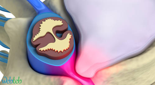 وافقت الـ FDA على جهاز جديد لتحفيز النخاع الشوكي وعلاج الألم المزمن وافقت الـ FDA على جهاز جديد لتحفيز النخاع الشوكي وعلاج الألم المزمن