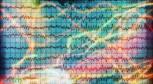 تشخيص تزامن متزايد لدى مرضى شلل الرعاش عن طريق فحص EEG تشخيص تزامن متزايد لدى مرضى شلل الرعاش عن طريق فحص EEG
