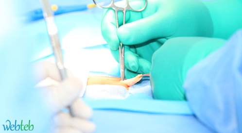 جراحة الفتق الإربي للأطفال - دليل للأهل جراحة الفتق الإربي للأطفال - دليل للأهل