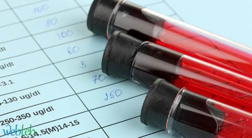عدم توجه النساء لإجراء فحوصات الـ HIV في سن الخصوبة عدم توجه النساء لإجراء فحوصات الـ HIV في سن الخصوبة