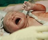 الولايات المتحدة: ولادة البيت أقل أمانا للجنين من ولادة المستشفى