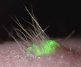 تطوير خلايا جلد مخبرياً تحمل الأمل في علاج تساقط الشعر