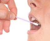 هل تؤثر البكتيريا المتواجدة في الفم على الإصابة بسرطان البنكرياس؟ 
