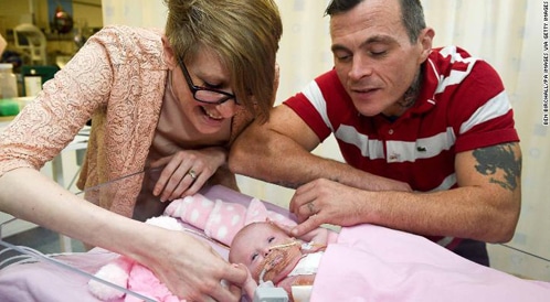 طفلة تنجو بعد جراحة لإدخال قلبها إلى صدرها
