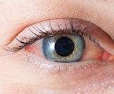 إزالة 14 دودة من عين إمراة في أمريكا