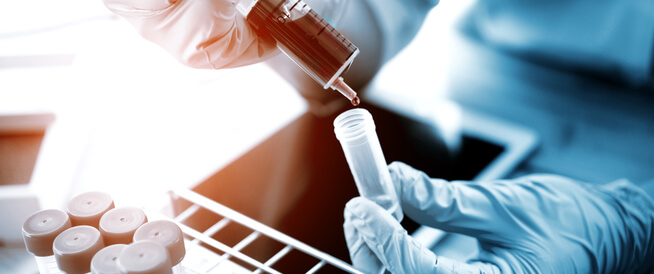 هل تساعد بلازما الدم في محاربة فيروس كورونا المستجد؟