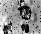 العلماء يحلون لغز مرض الطاعون الموت الأسود