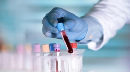 تقدم جديد: اكتشاف السرطان مبكرًا من خلال فحص الدم 