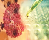 دراسة: طريقة جديدة محتملة لمنع السرطان من التطور لمقاومة العلاج