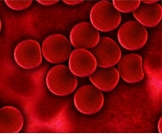 أمراض الدم المختلفة: صح أم خطأ