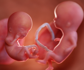 كيف يحدث الحمل بتوأم بالصور