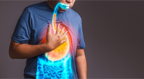 أعشاب لعلاج ارتجاع المرئ بالصور