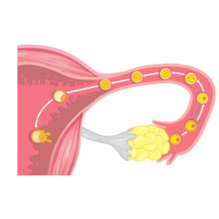 كيف يمكن حساب الحمل بالأسابيع؟