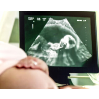 طرق أخرى لحساب الحمل