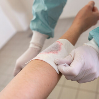 ما بعد غسيل الكلى الدموي