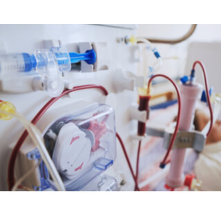 مرحلة غسيل الكلى الصفاقي 