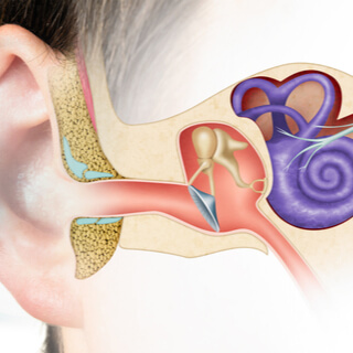 أنواع التهاب الأذن