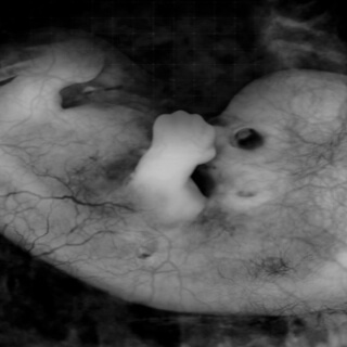 شكل الجنين في الأسبوع الأول من الحمل