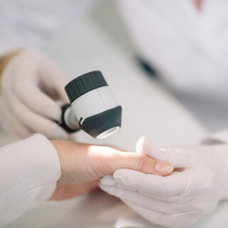 تشخيص الجرب