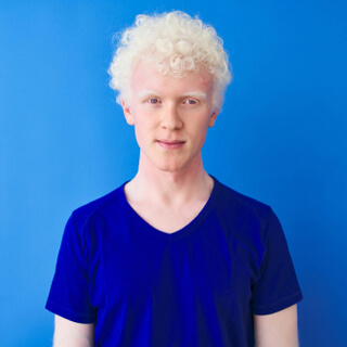 مرض البرص بالصور