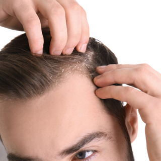 4. يساعد في علاج قشرة الرأس 4. يساعد في علاج قشرة الرأس