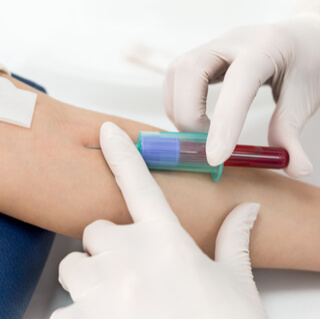 تشخيص الإصابة بالتهاب المرارة