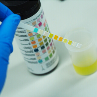 هل اختبار الحمل بالسكر دقيق؟