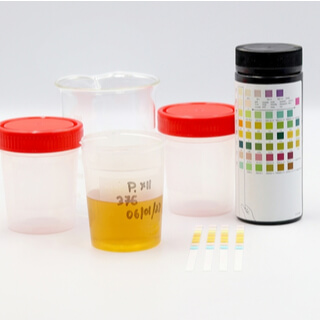 ماذا تحتاج لإجراء اختبار الحمل بالسكر؟