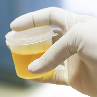 كيفية عمل اختبار الحمل بالكلور