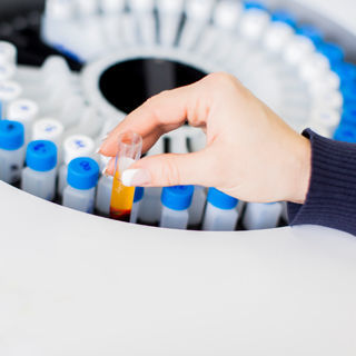 ظهور دم في البول