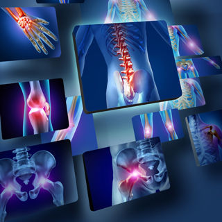 تأثير المرض على العظام