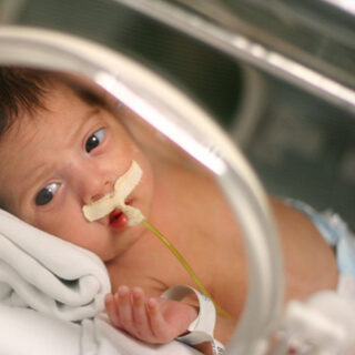 مضاعفات الولادة المبكرة