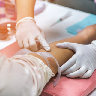 3. فحص الوريد