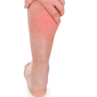 تورم الساقين