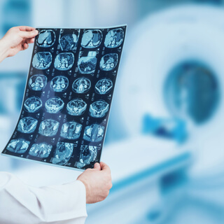 طرق تشخيص الناسور