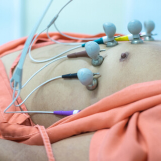 2. الخطوة الثانية من قسطرة القلب