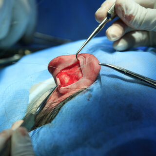 أثناء إجراء عملية تجميل الأذن