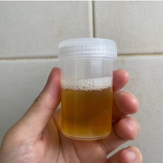 1. تغييرات في التبول