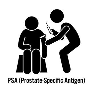 متى يجب الخضوع لفحص البروستاتا؟ 