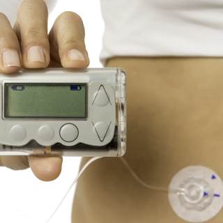 إذا كنت بحاجة إلى المزيد من التحكم