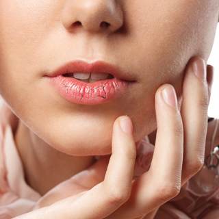 المشكلة الأولى: تشقق الشفاه