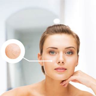 المشكلة: البشرة الجافة