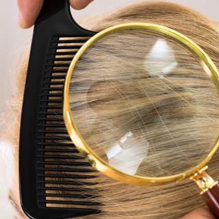 كيفية الكشف عن قمل الرأس